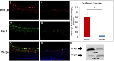 Parvalbumin expression changes with retinal ganglion cell degeneration